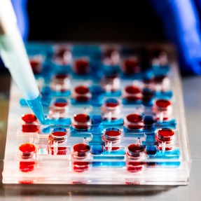 A close-up of lab equipment being used, with a gloved hand visible.